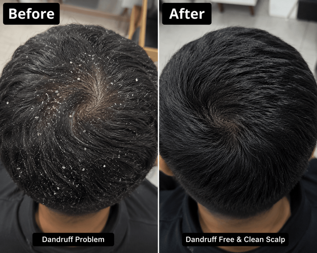 Best Secret  For Hair Growth