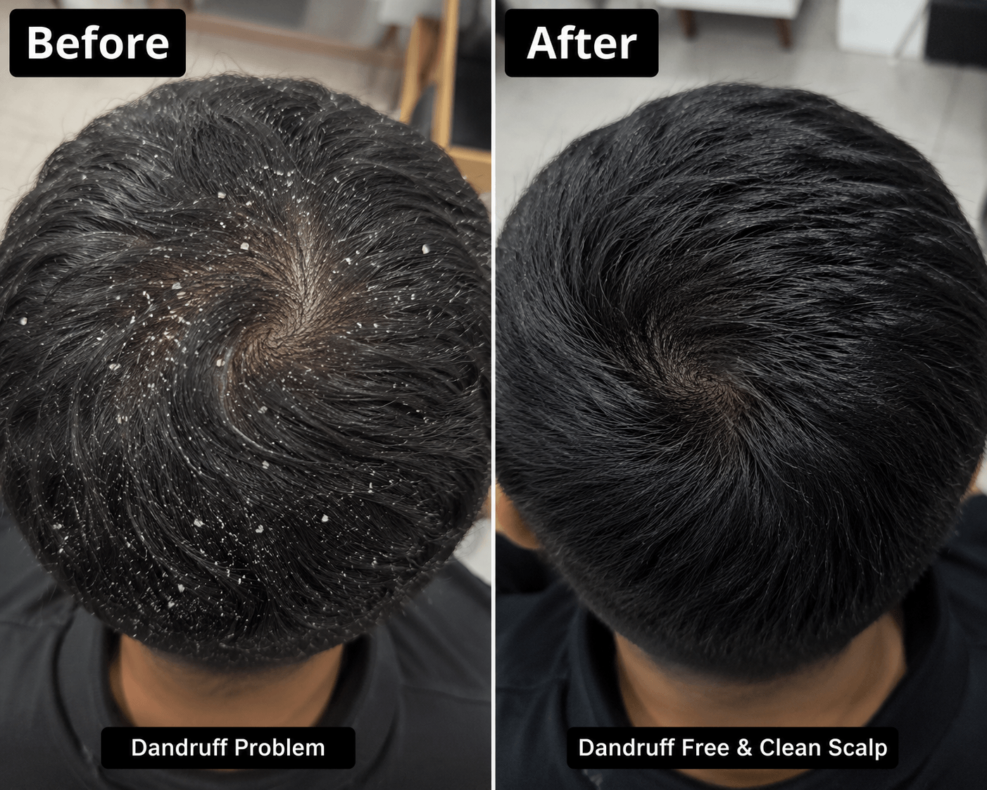 Best Secret  For Hair Growth
